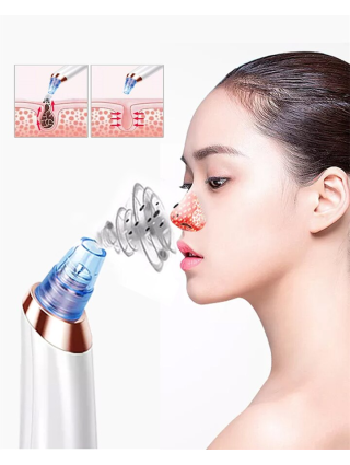 Aspirateur de Points Noirs et Sébum 4 en 1 - Soins de Visage