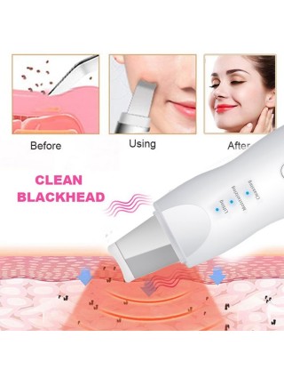 Épurateur ultrasonic 3 en 1 - Lifting, hydratation et gommage