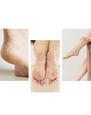 Râpe Pieds - Soins des Pieds - Peau Morte Callosités Durillons Corne