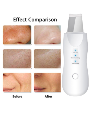 Épurateur ultrasonic 3 en 1 - Lifting, hydratation et gommage
