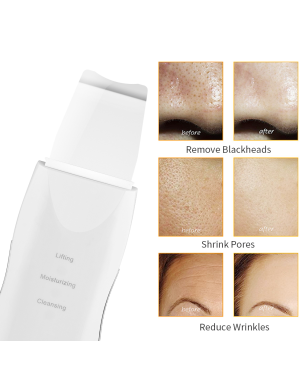 Épurateur ultrasonic 3 en 1 - Lifting, hydratation et gommage