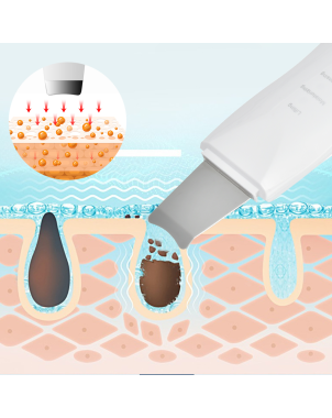 Épurateur ultrasonic 3 en 1 - Lifting, hydratation et gommage
