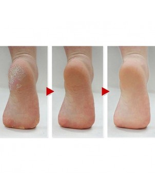 râpe pied htc , anti callosité , pédicure , soin pieds