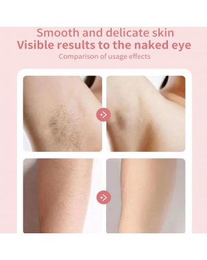 Epilateur Electrique Portable avec Câble USB pour Epilation Visage Corps Zone Intime Epilator